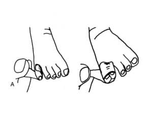 Tapen bei Curly toe