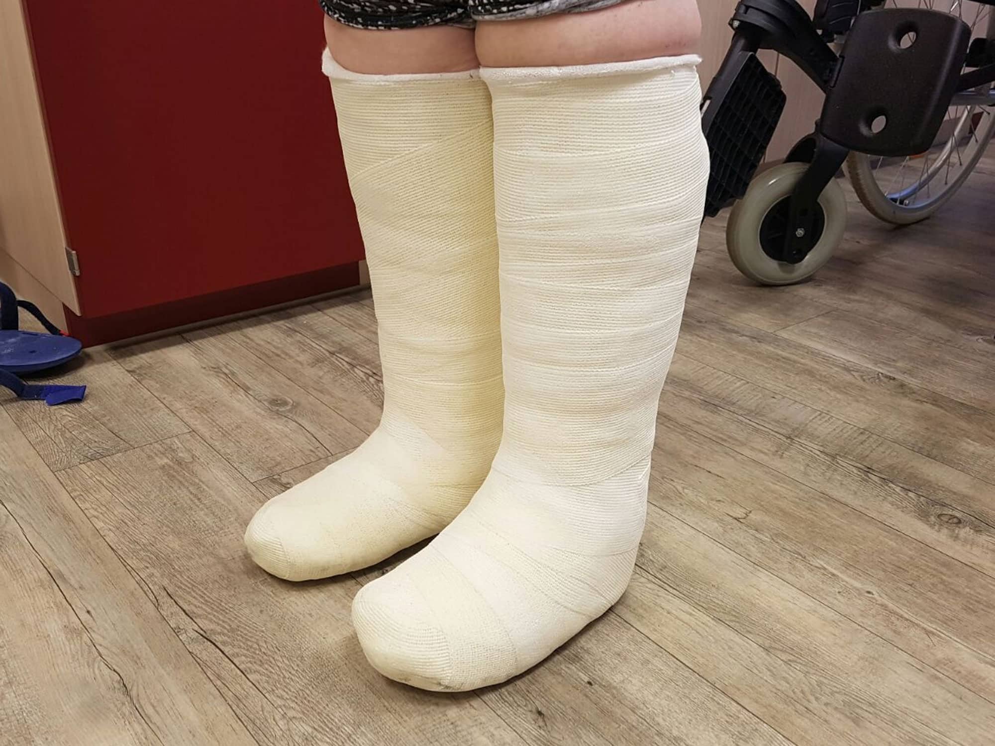 Gips fuß Wie lange