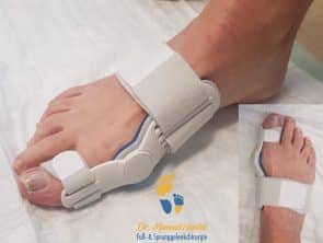 Hallux valgus Orthese