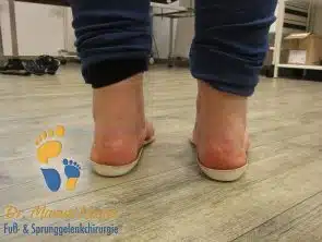 Schuheinlagen bei Plattfuß