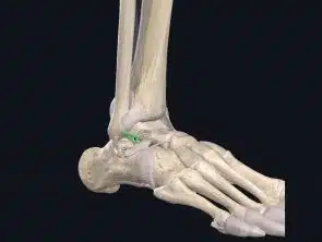 Ligamentum fibulo-talare anterius (LFTA)