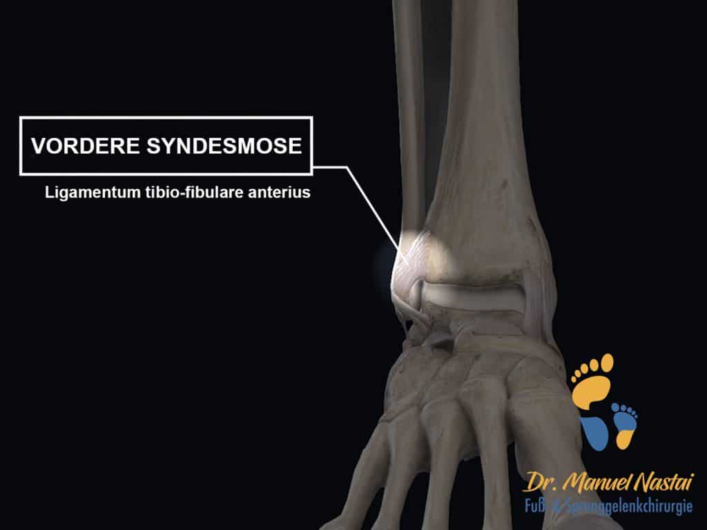 Vordere Syndesmose