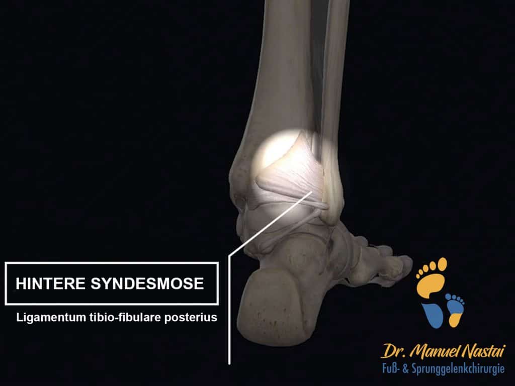 Hintere Syndesmose