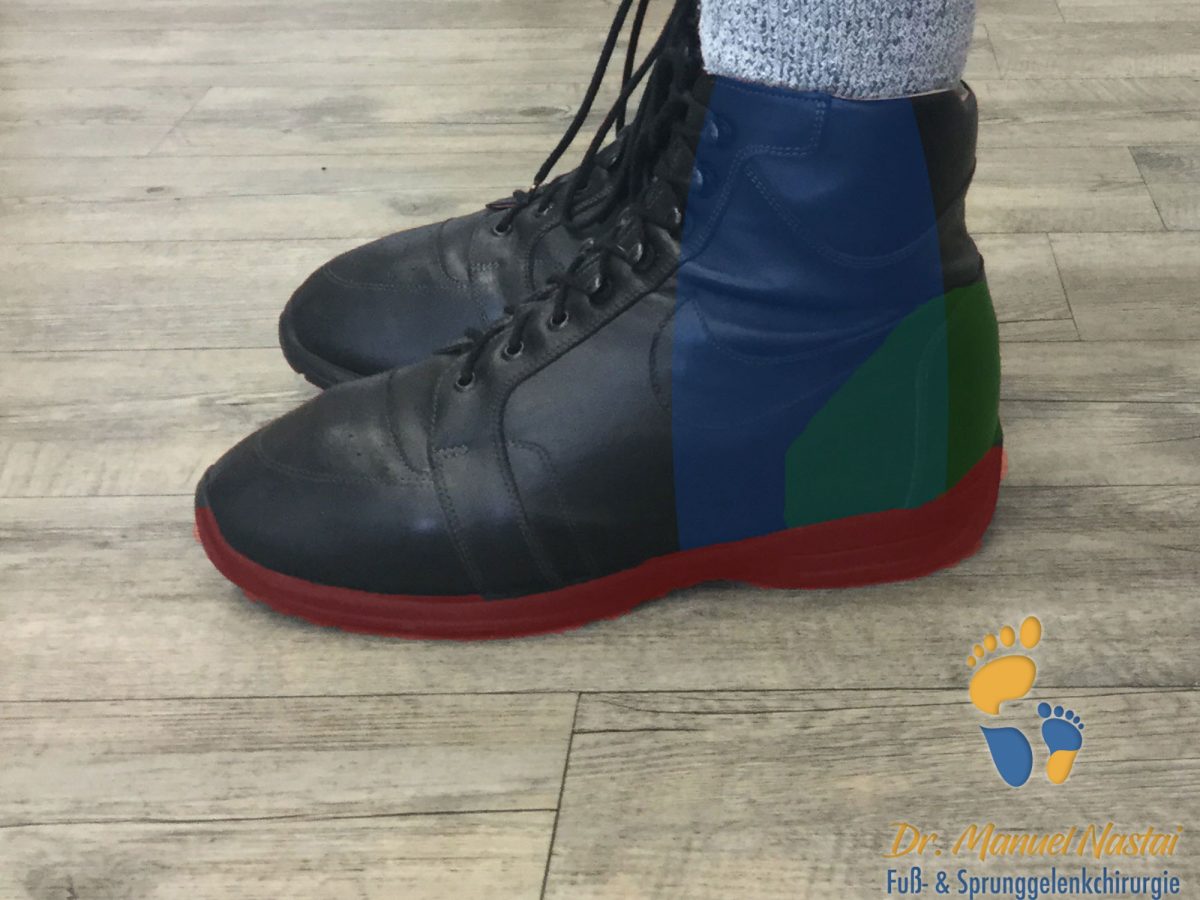 Bei Welchen Schuhen Kann Man Die Sohle Rausnehmen Orthopädische Schuhe - Dr.-medic Manuel Nastai