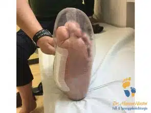 Probe eines orthopädischen Schuhes